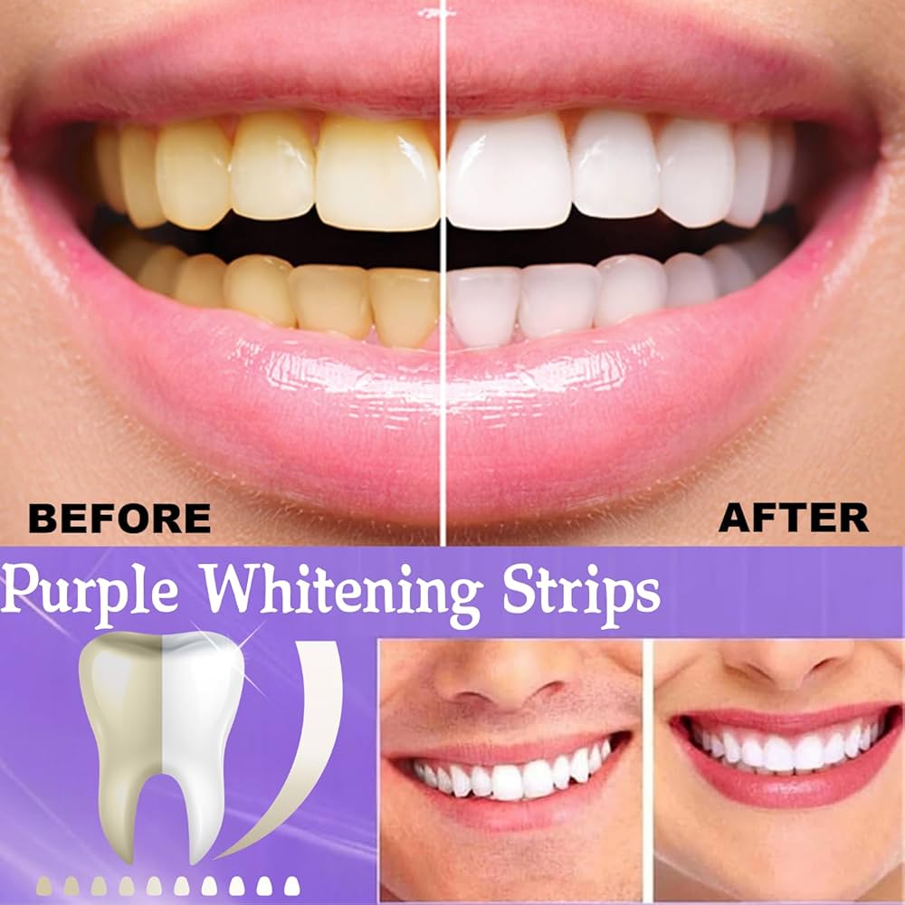 Purple Whitening Strips — 7-Day Smile Transformation (Sensitivity-Free)