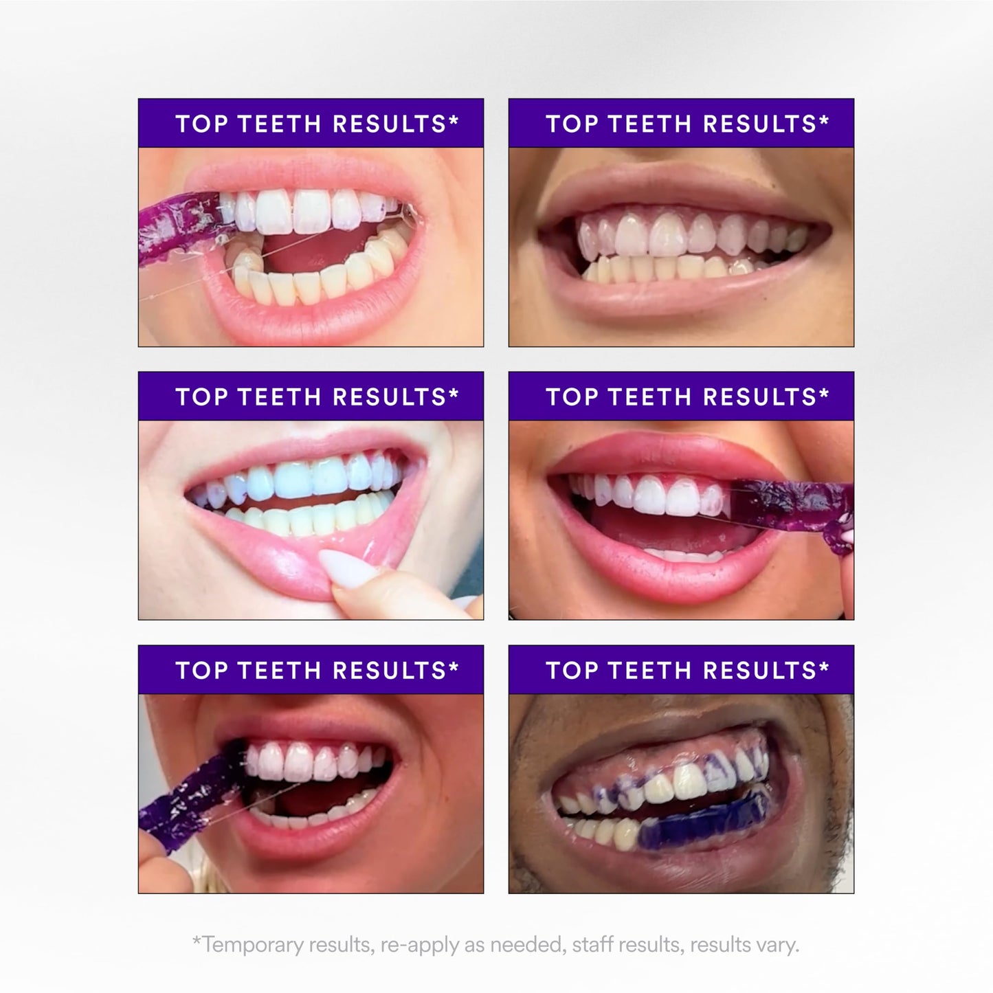 Purple Whitening Strips — 7-Day Smile Transformation (Sensitivity-Free)
