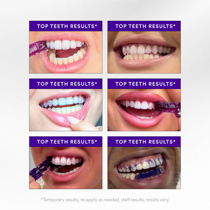 Purple Whitening Strips — 7-Day Smile Transformation (Sensitivity-Free)